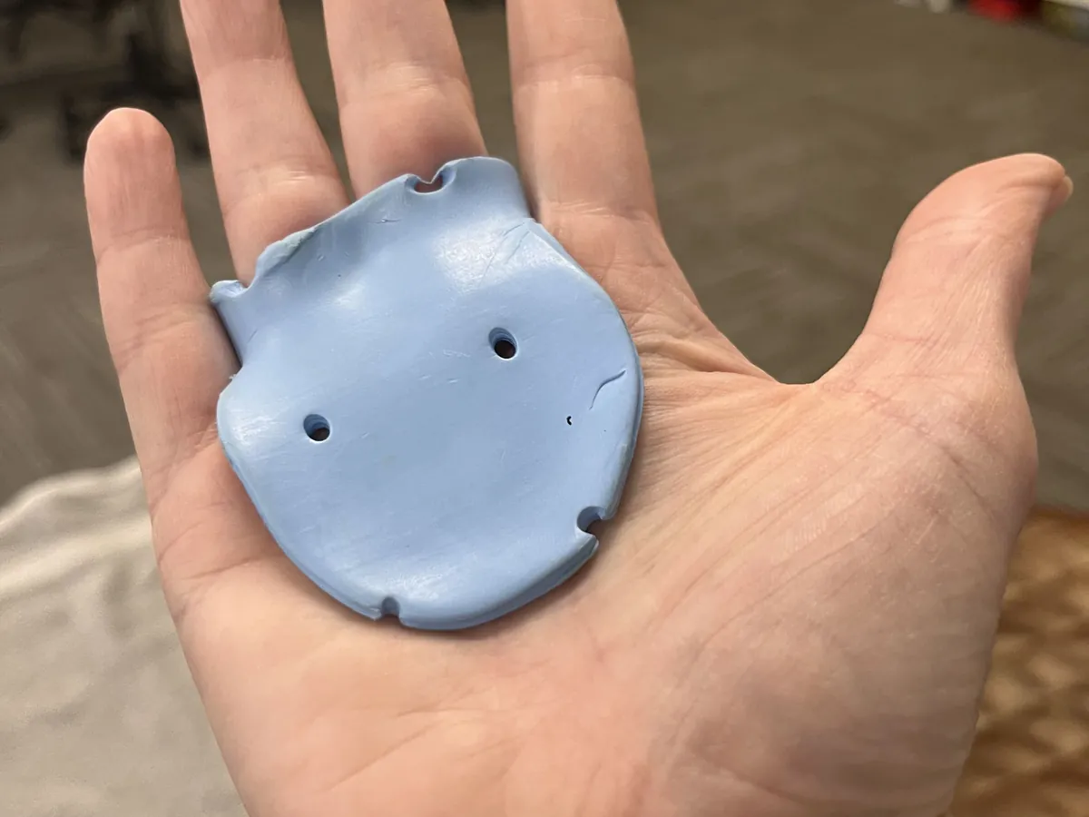 Light blue custom molded thermoplastic splint resting in an open palm