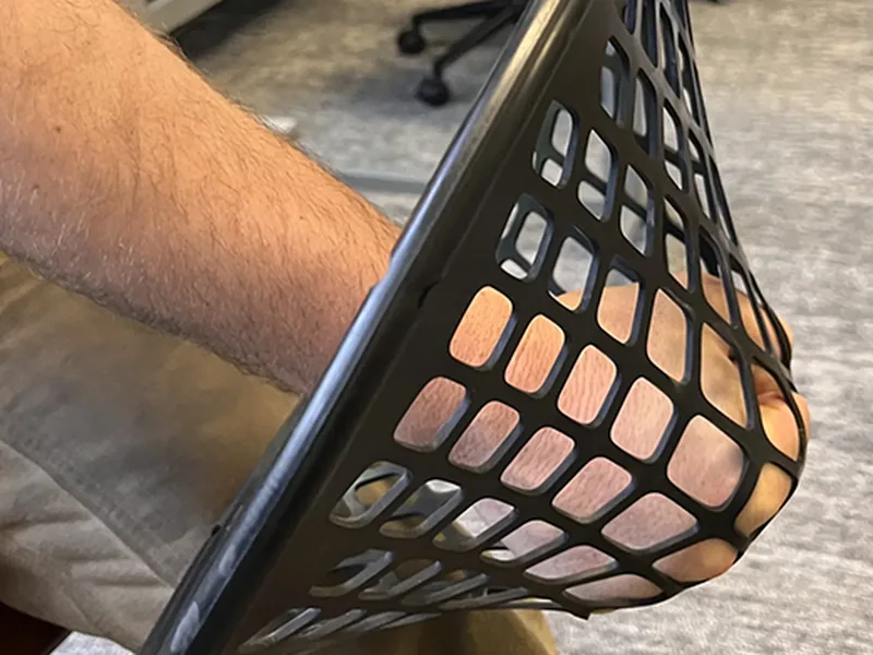 Custom protective orthosis on a patient&rsquo;s forearm