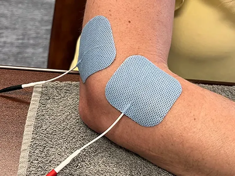 Electrode pads placed on a patient&rsquo;s elbow during treatment