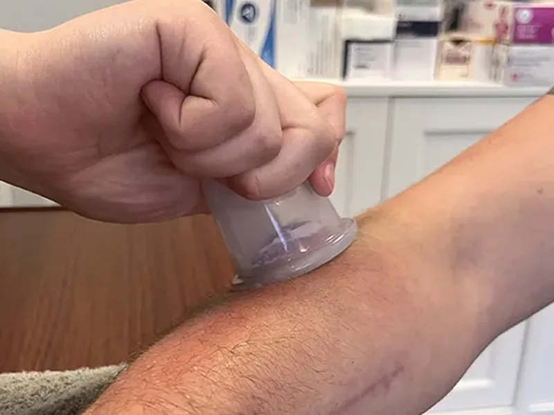 Instrument-assisted soft tissue tool used along a patient&rsquo;s forearm