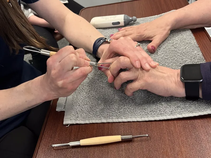 Close-up of hands-on therapy work on a patient&rsquo;s hand and fingers