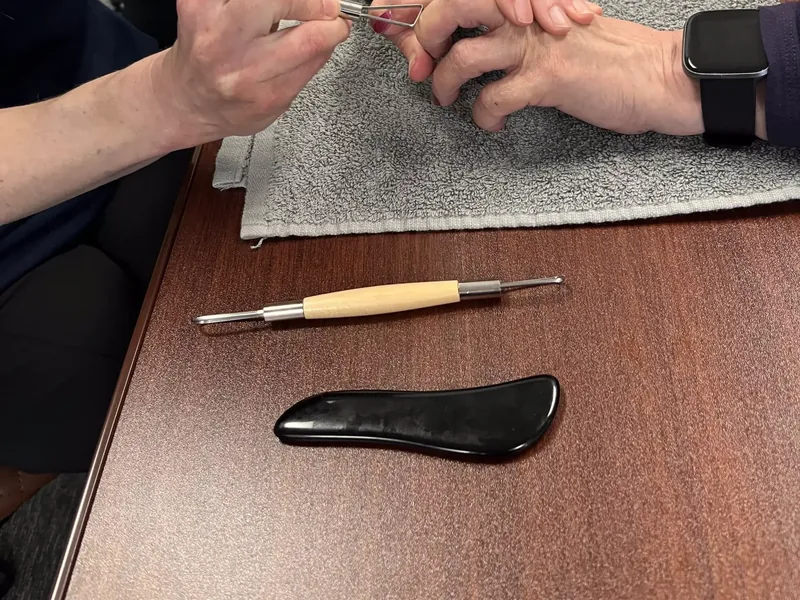 Close-up of hands-on therapy work on a patient&rsquo;s hand and fingers