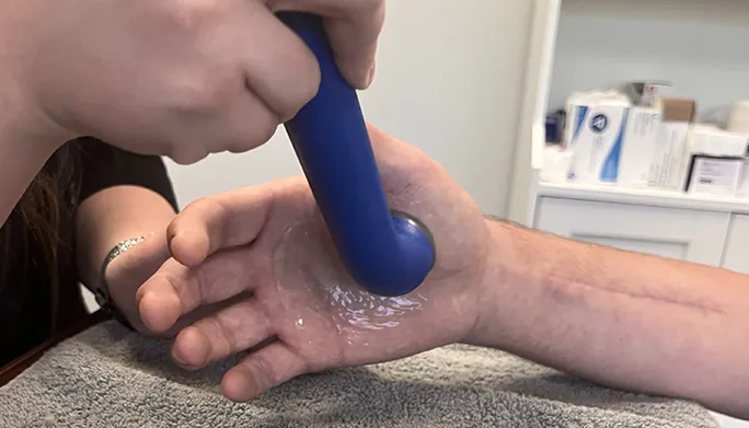 Therapeutic ultrasound wand with gel applied to a patient&rsquo;s palm and wrist