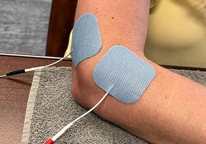 Electrode pads placed on a patient's elbow during a treatment session