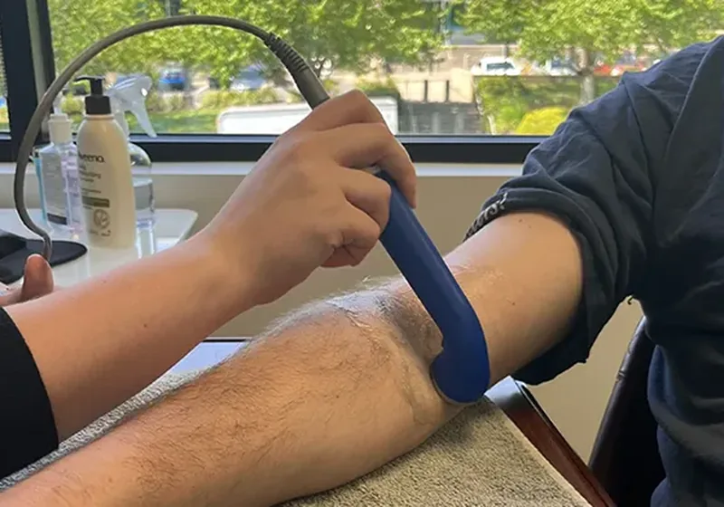 Instrument-assisted soft tissue tool being used along a patient's forearm