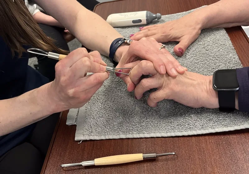 Therapist using instrument-assisted work on a patient's hand
